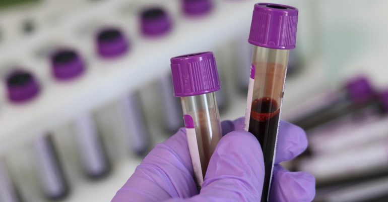 first-res blood sample